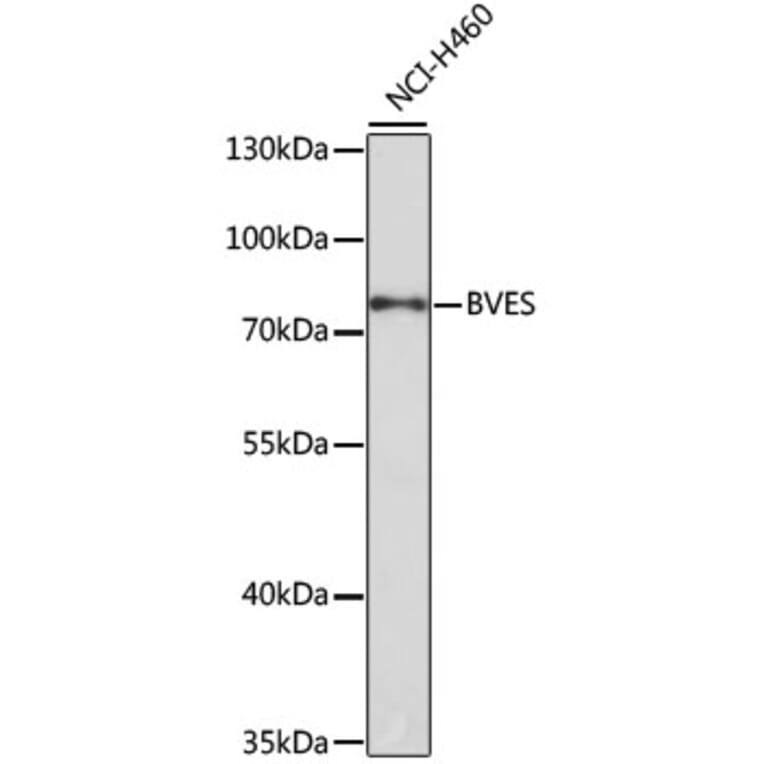 Western Blot - Anti-BVES Antibody (A12545) - Antibodies.com