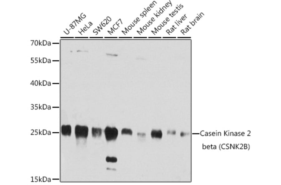 Western Blot - Anti-Caspase-3 Antibody (A12546) - Antibodies.com