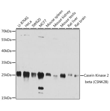 Western Blot - Anti-Caspase-3 Antibody (A12546) - Antibodies.com