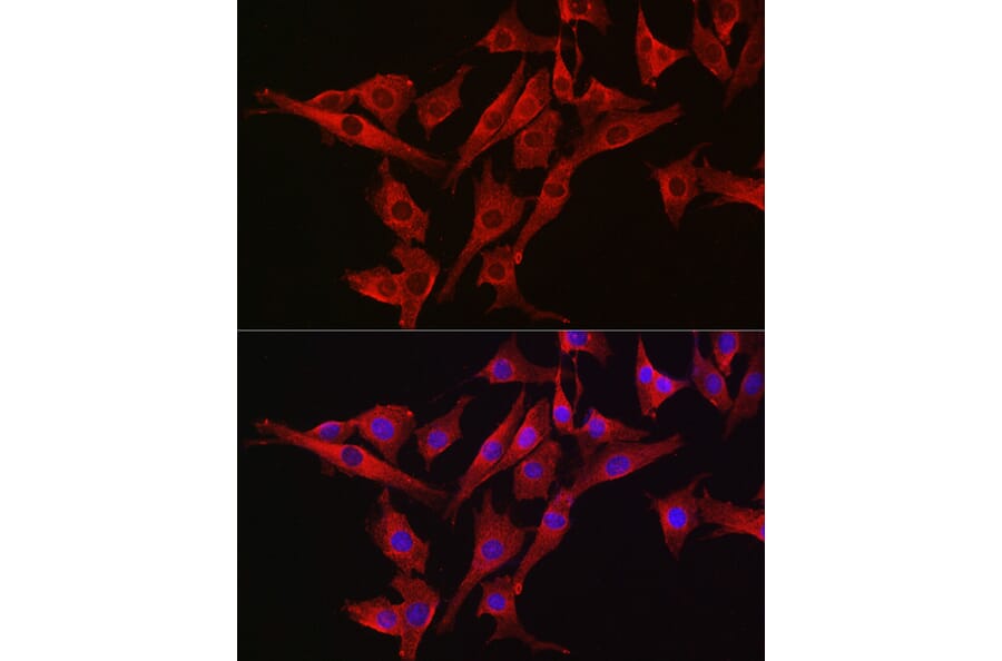 Immunofluorescence - Anti-Caspase-3 Antibody (A12546) - Antibodies.com
