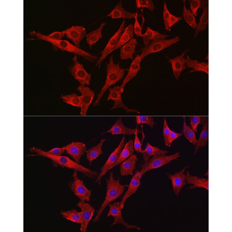 Immunofluorescence - Anti-Caspase-3 Antibody (A12546) - Antibodies.com