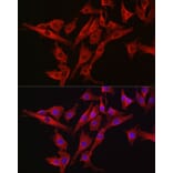 Immunofluorescence - Anti-Caspase-3 Antibody (A12546) - Antibodies.com