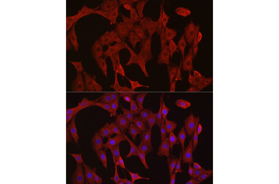 Immunofluorescence - Anti-Caspase-3 Antibody (A12546) - Antibodies.com