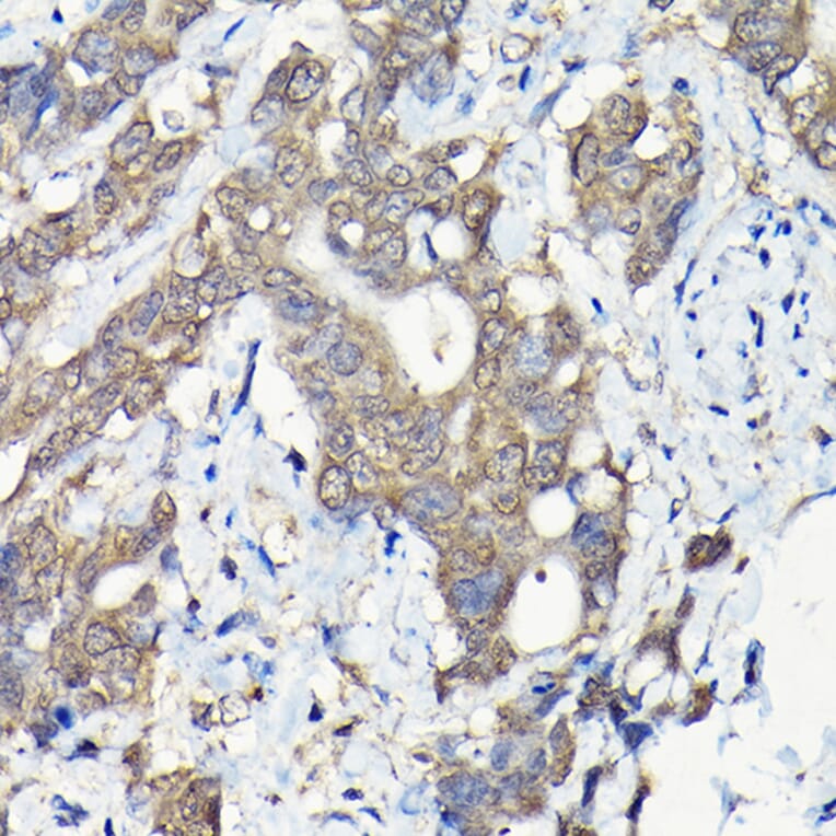 Immunohistochemistry - Anti-Caspase-8 Antibody (A12547) - Antibodies.com