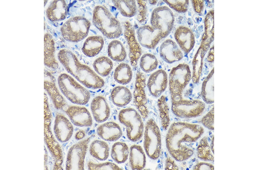Immunohistochemistry - Anti-Caspase-8 Antibody (A12547) - Antibodies.com