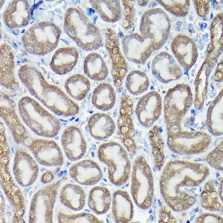 Immunohistochemistry - Anti-Caspase-8 Antibody (A12547) - Antibodies.com