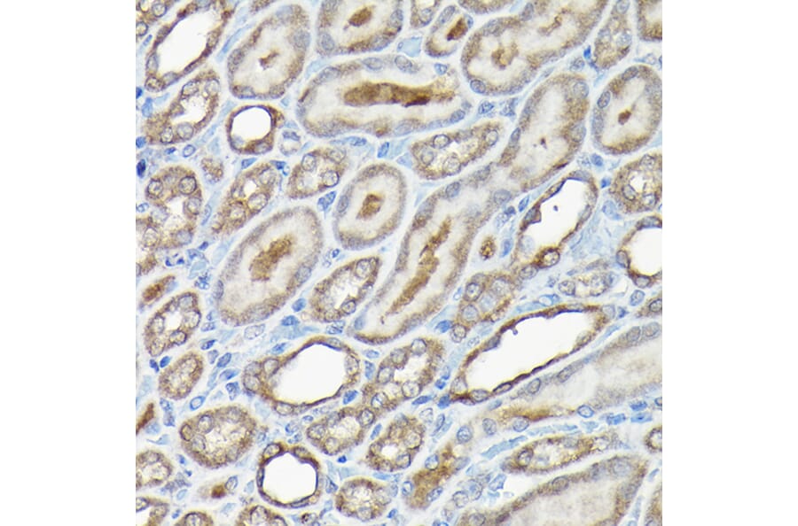 Immunohistochemistry - Anti-Caspase-8 Antibody (A12547) - Antibodies.com
