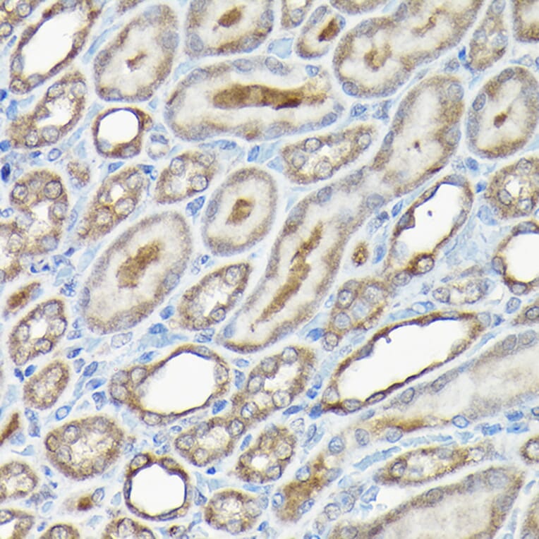 Immunohistochemistry - Anti-Caspase-8 Antibody (A12547) - Antibodies.com