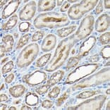Immunohistochemistry - Anti-Caspase-8 Antibody (A12547) - Antibodies.com