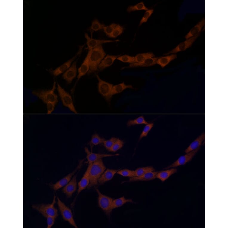 Immunofluorescence - Anti-Caspase-8 Antibody (A12547) - Antibodies.com
