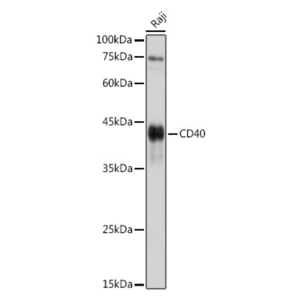 Western Blot - Anti-CD40 Antibody (A12548) - Antibodies.com