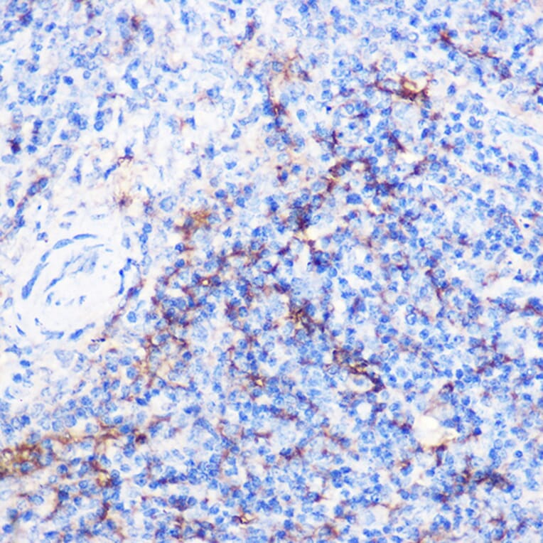 Immunohistochemistry - Anti-CD40 Antibody (A12548) - Antibodies.com
