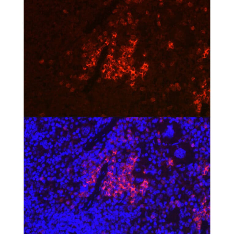 Immunofluorescence - Anti-CD40 Antibody (A12548) - Antibodies.com