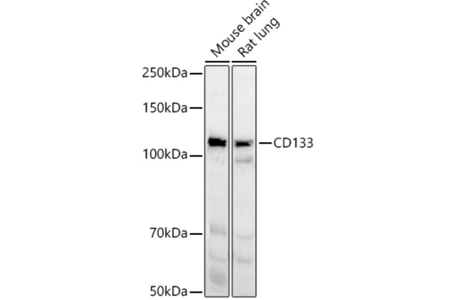 Western Blot - Anti-CD133 Antibody (A12549) - Antibodies.com