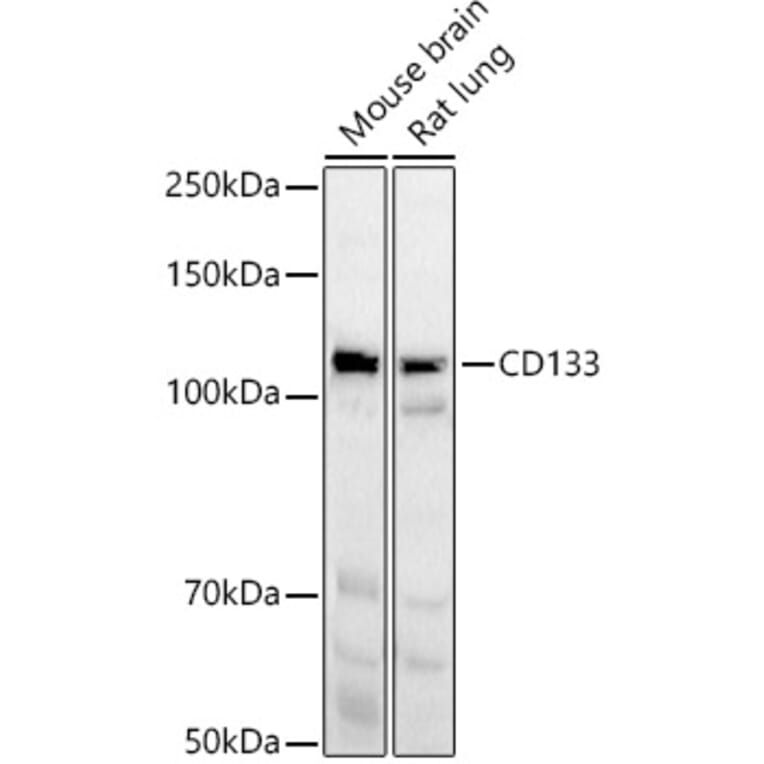 Western Blot - Anti-CD133 Antibody (A12549) - Antibodies.com