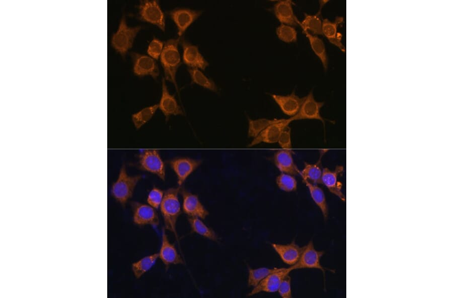 Immunofluorescence - Anti-CD133 Antibody (A12549) - Antibodies.com