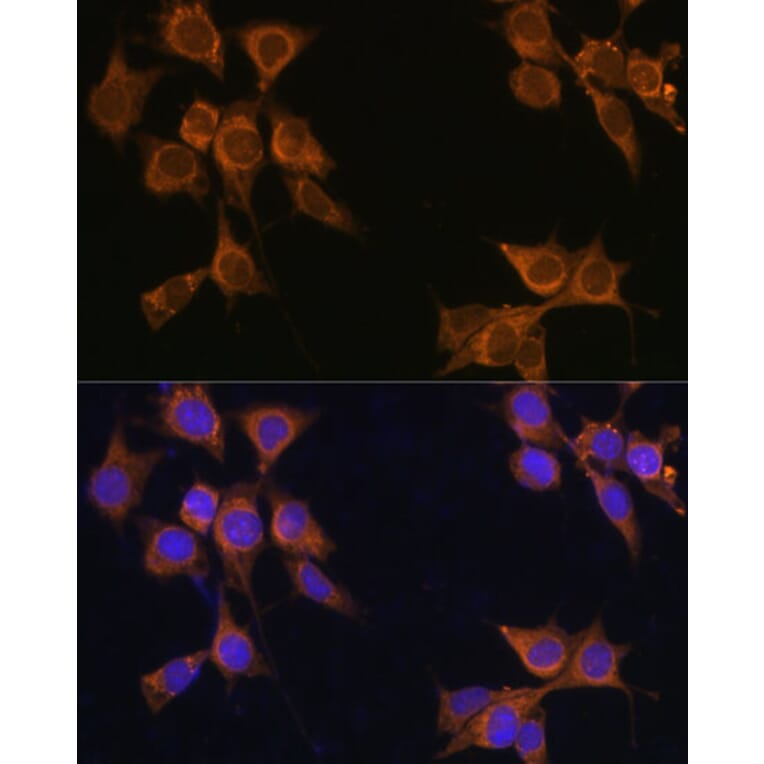 Immunofluorescence - Anti-CD133 Antibody (A12549) - Antibodies.com