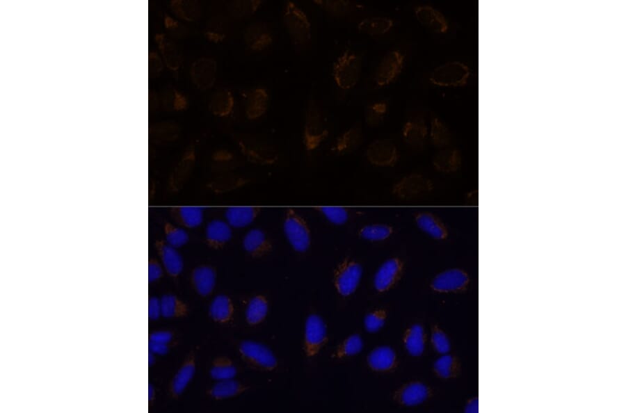 Immunofluorescence - Anti-CD133 Antibody (A12549) - Antibodies.com