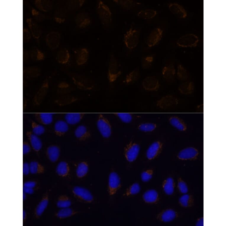 Immunofluorescence - Anti-CD133 Antibody (A12549) - Antibodies.com