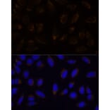 Immunofluorescence - Anti-CD133 Antibody (A12549) - Antibodies.com