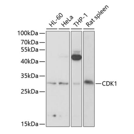 Western Blot - Anti-CDK1 Antibody (A12550) - Antibodies.com