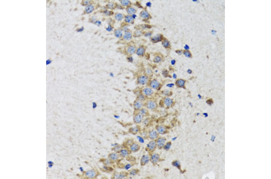 Immunohistochemistry - Anti-CDK1 Antibody (A12550) - Antibodies.com