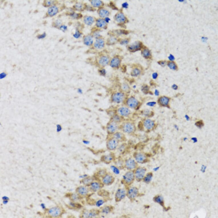 Immunohistochemistry - Anti-CDK1 Antibody (A12550) - Antibodies.com