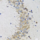 Immunohistochemistry - Anti-CDK1 Antibody (A12550) - Antibodies.com