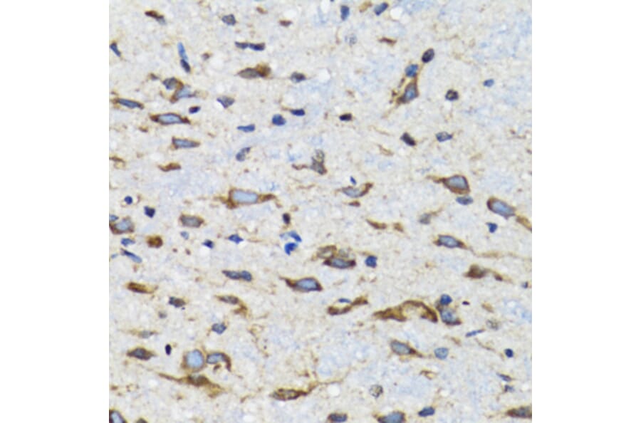Immunohistochemistry - Anti-CDK1 Antibody (A12550) - Antibodies.com