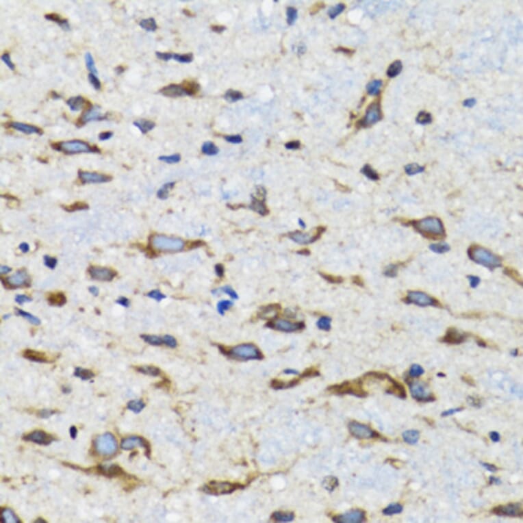 Immunohistochemistry - Anti-CDK1 Antibody (A12550) - Antibodies.com