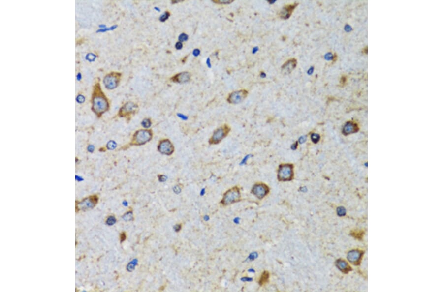 Immunohistochemistry - Anti-CDK1 Antibody (A12550) - Antibodies.com