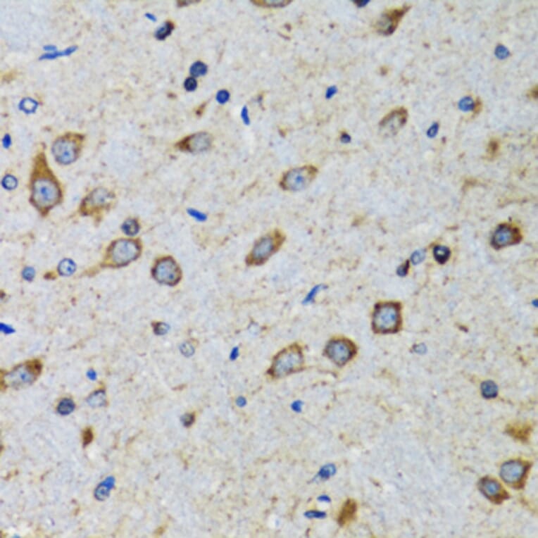 Immunohistochemistry - Anti-CDK1 Antibody (A12550) - Antibodies.com