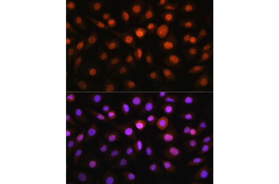 Immunofluorescence - Anti-DDIT3 Antibody (A12551) - Antibodies.com
