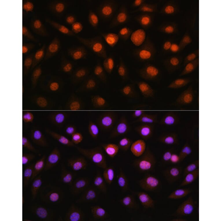 Immunofluorescence - Anti-DDIT3 Antibody (A12551) - Antibodies.com