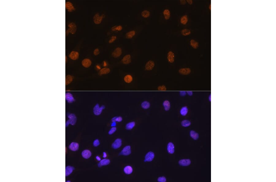 Immunofluorescence - Anti-DDIT3 Antibody (A12551) - Antibodies.com