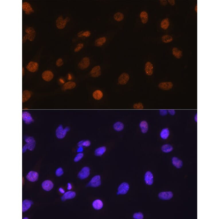 Immunofluorescence - Anti-DDIT3 Antibody (A12551) - Antibodies.com