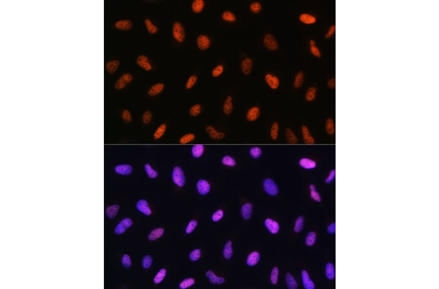 Immunofluorescence - Anti-DDIT3 Antibody (A12551) - Antibodies.com