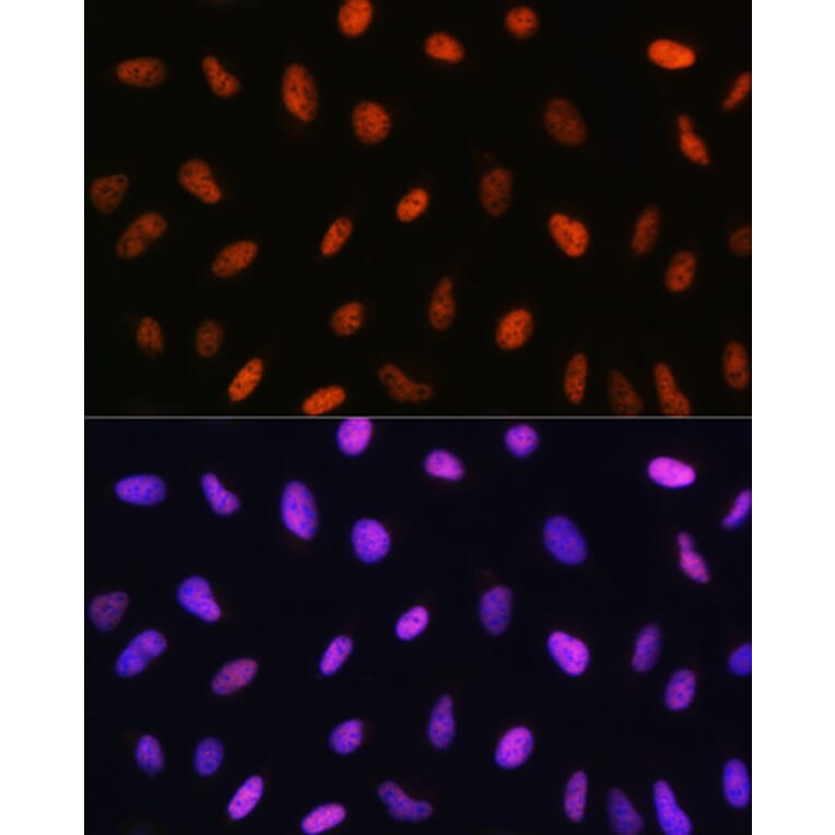 Immunofluorescence - Anti-DDIT3 Antibody (A12551) - Antibodies.com