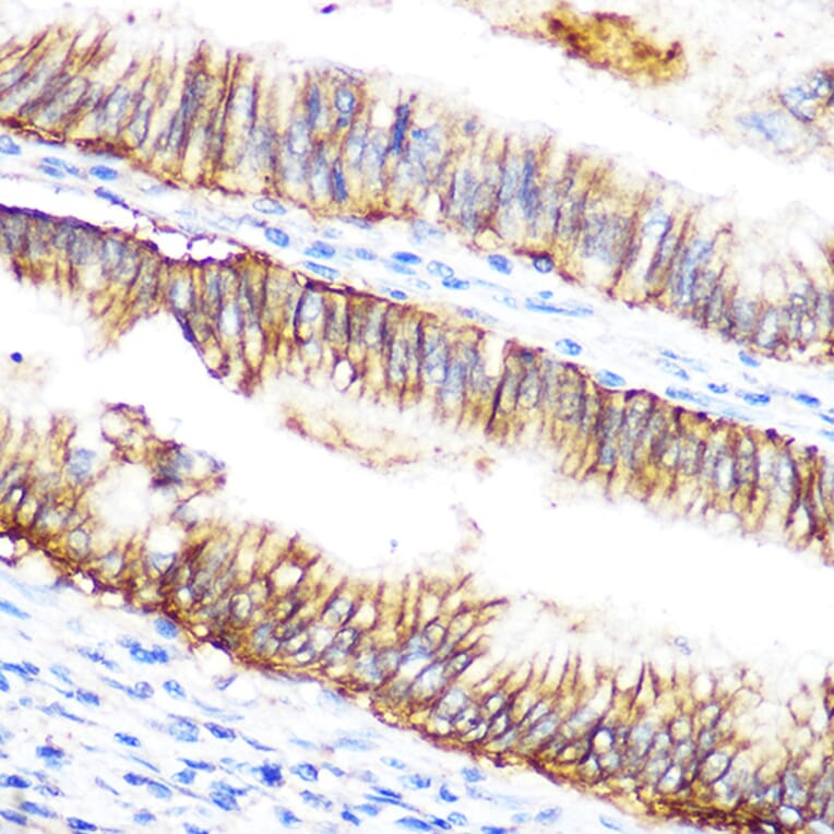 Immunohistochemistry - Anti-Raf1 Antibody (A12552) - Antibodies.com