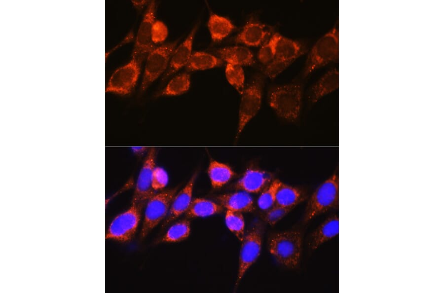 Immunofluorescence - Anti-Raf1 Antibody (A12552) - Antibodies.com