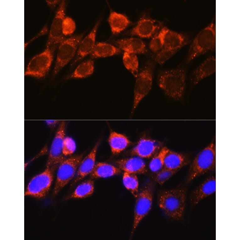Immunofluorescence - Anti-Raf1 Antibody (A12552) - Antibodies.com