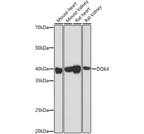 Western Blot - Anti-DOK4 Antibody (A12554) - Antibodies.com