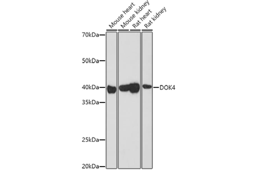 Western Blot - Anti-DOK4 Antibody (A12554) - Antibodies.com