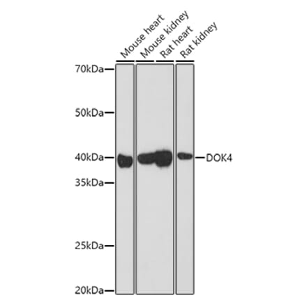 Western Blot - Anti-DOK4 Antibody (A12554) - Antibodies.com