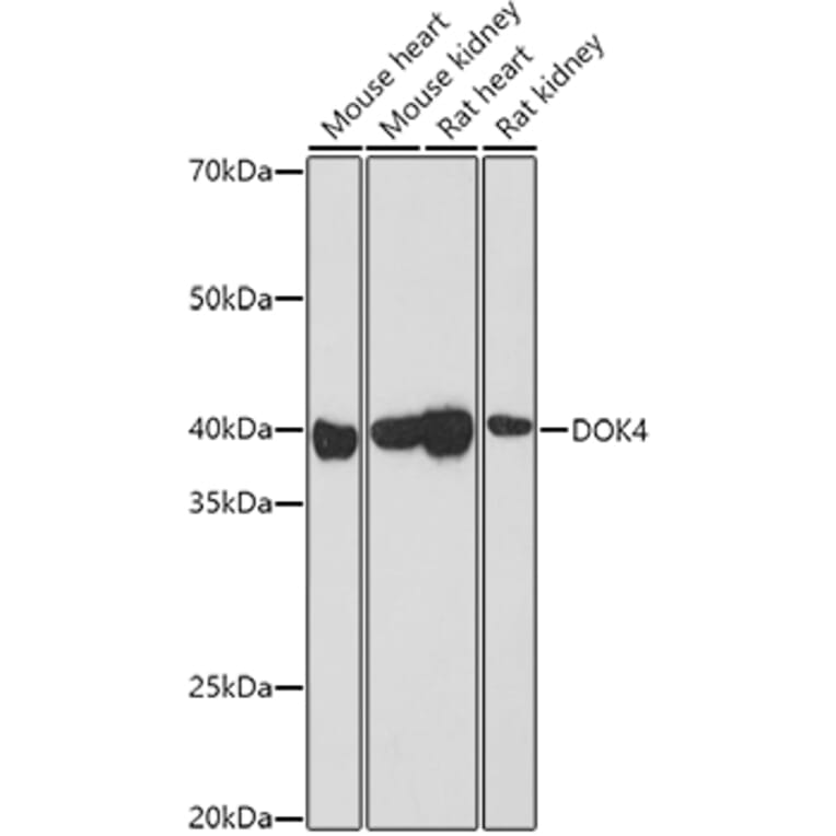 Western Blot - Anti-DOK4 Antibody (A12554) - Antibodies.com
