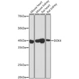 Western Blot - Anti-DOK4 Antibody (A12554) - Antibodies.com