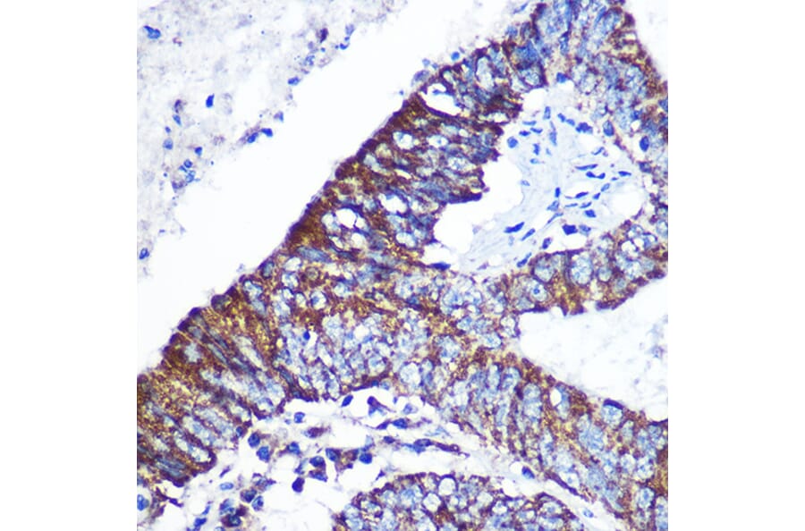 Immunohistochemistry - Anti-DOK4 Antibody (A12554) - Antibodies.com