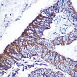 Immunohistochemistry - Anti-DOK4 Antibody (A12554) - Antibodies.com