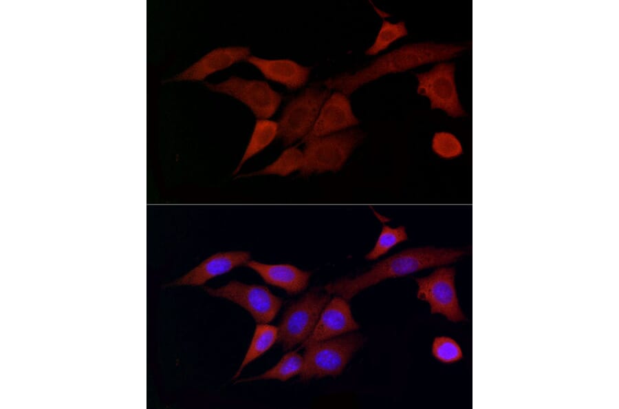 Immunofluorescence - Anti-DOK4 Antibody (A12554) - Antibodies.com
