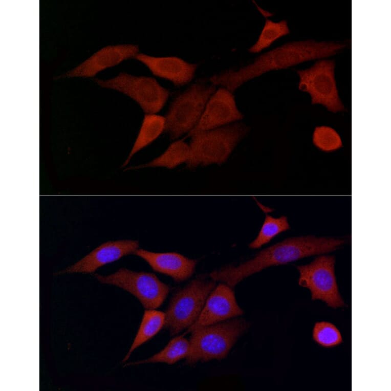 Immunofluorescence - Anti-DOK4 Antibody (A12554) - Antibodies.com